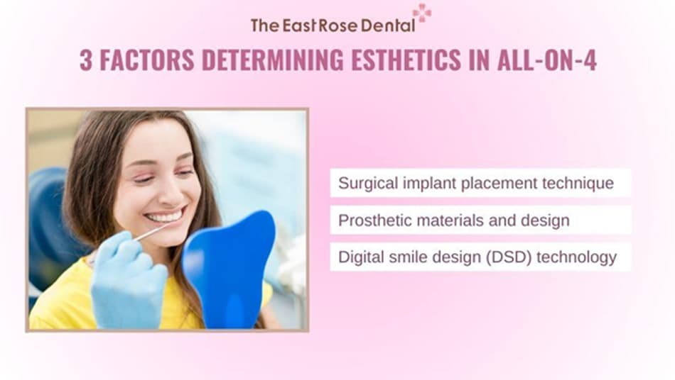 All-on-4 is a complex restoration that requires precision and high clinical expertise