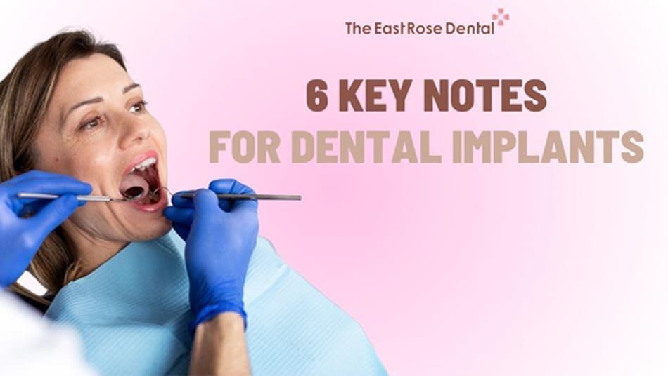 Important Considerations Before and After Dental Implant Placement
