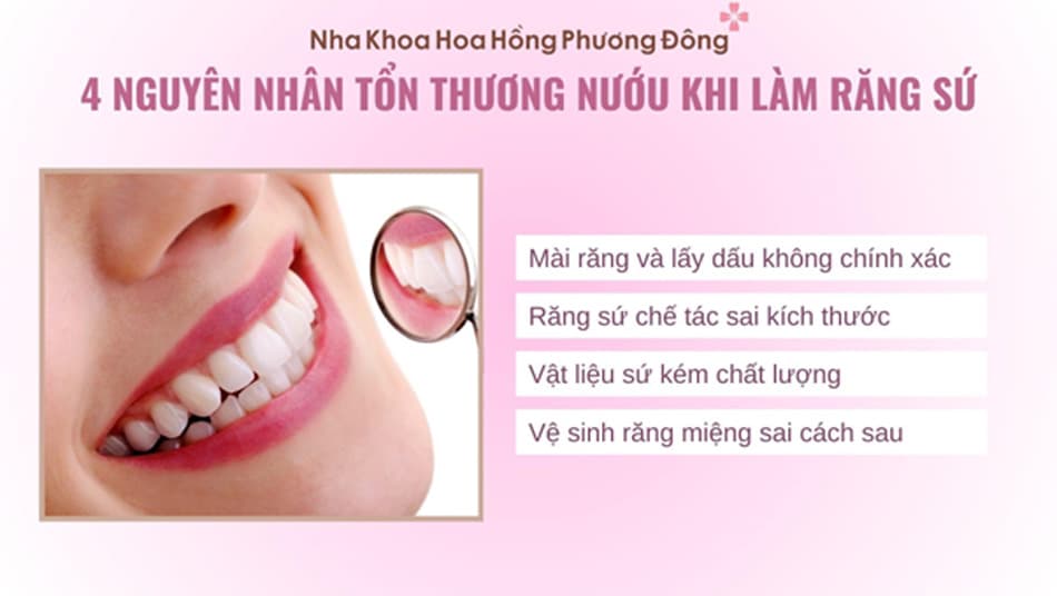 4 Nguyên nhân chính gây nên tình trạng nướu viêm sưng sau khi làm răng sứ