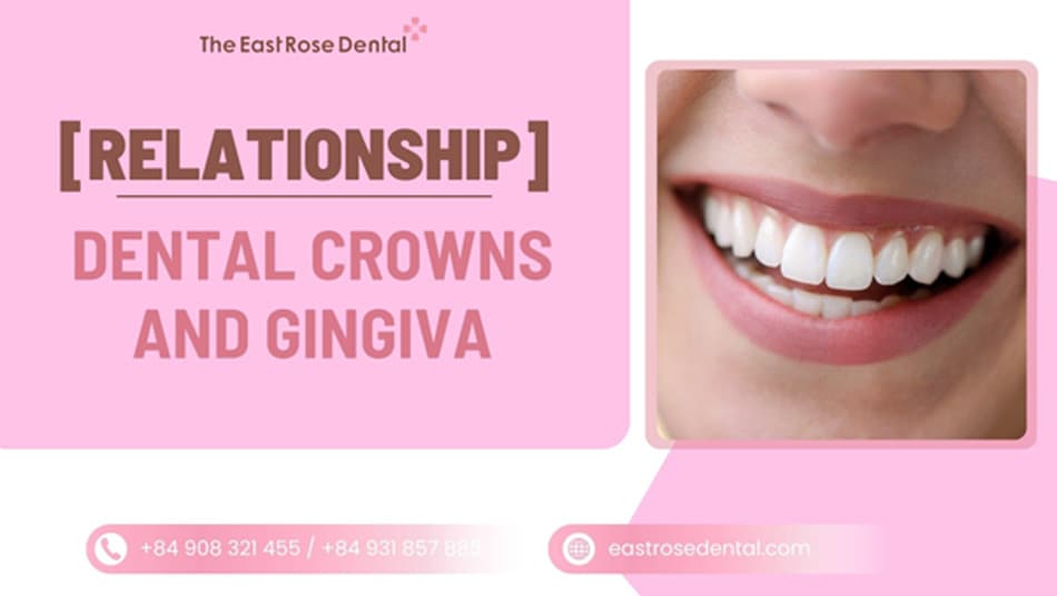 Porcelain Crowns and Gum Health: The Essential Connection You Need to Know