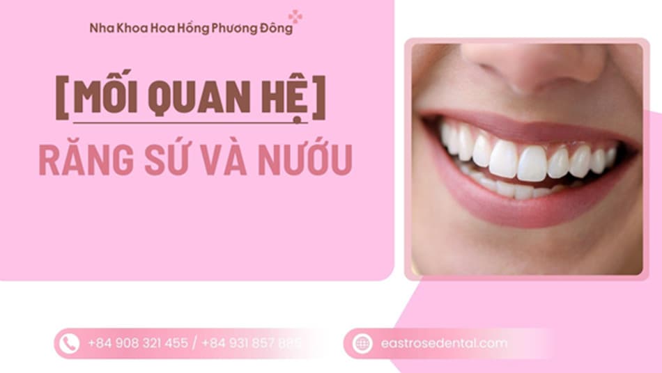 Răng sứ và sức khỏe nướu: Mối liên hệ mật thiết bạn cần biết