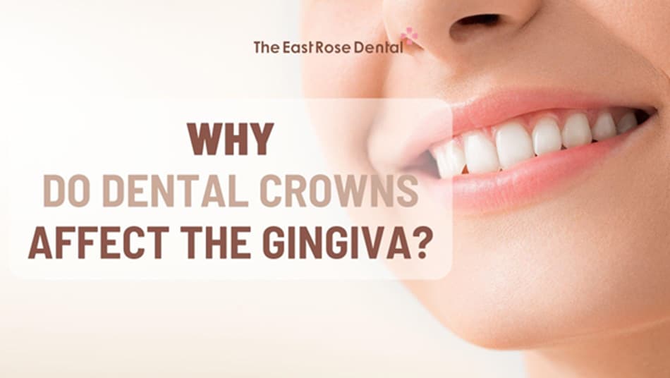 Why Porcelain Crowns Directly Affect Gum Health