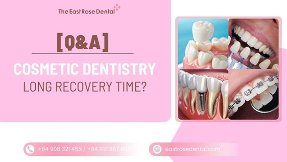 Do You Need Long Recovery Time After Cosmetic Dental Treatment?