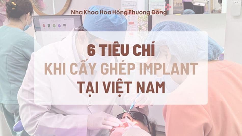 Cần lưu ý một số vấn đề trước khi quyết định về Việt Nam cấy ghép Implant