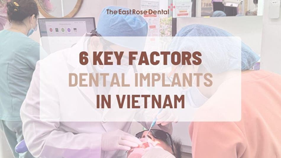 Important Things to Consider Before Coming to Vietnam for Dental Implants