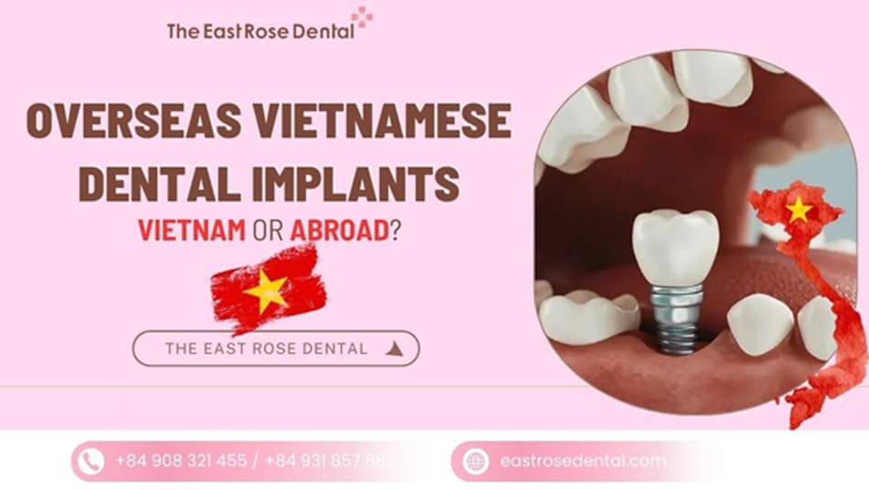Should You Get Dental Implants in Vietnam or Overseas?