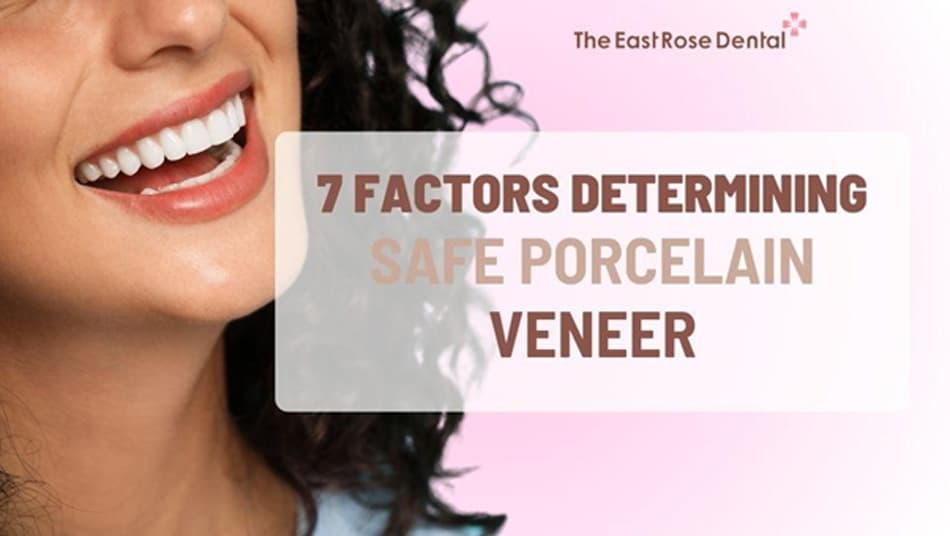 7 Factors That Influence the Durability and Safety of Veneers