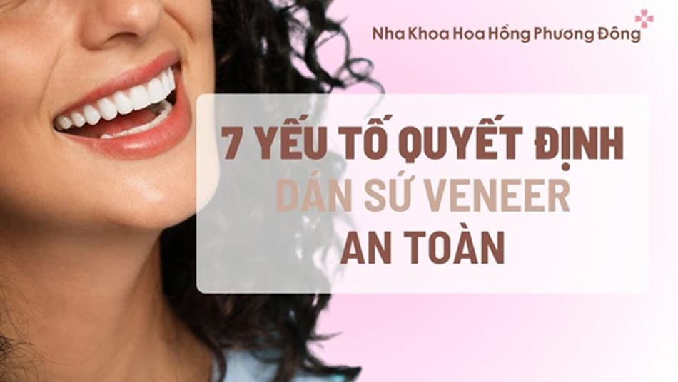 7 Yếu tố ảnh hưởng đến độ bền và an toàn khi bạn dán răng sứ Veneer