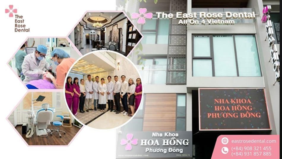 Nha Khoa Hoa Hồng Phương Đông là địa chỉ phục hình All-on-4 uy tín tại Tp.HCM