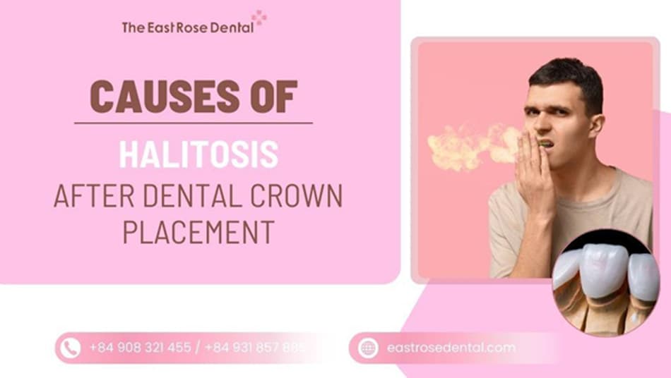 Bad Breath from Porcelain Crowns: Real Causes and Effective Solutions