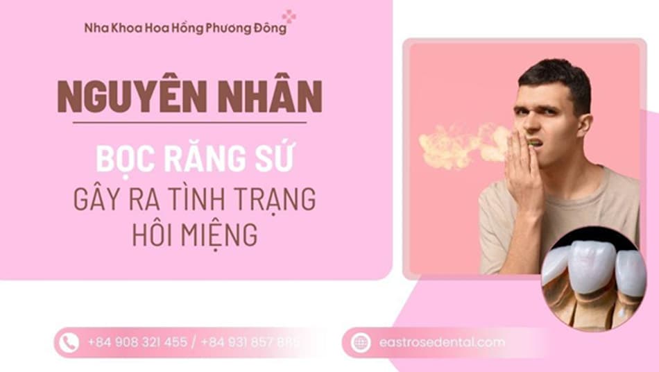 Răng sứ bị hôi miệng: Nguyên nhân thật sự và cách khắc phục triệt để