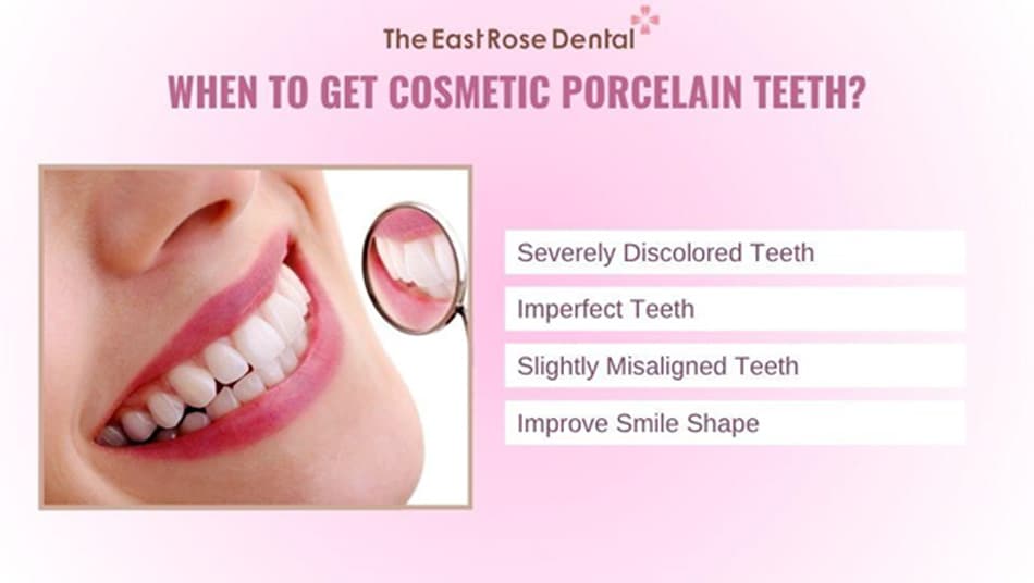 Choose cosmetic crowns if your teeth are healthy