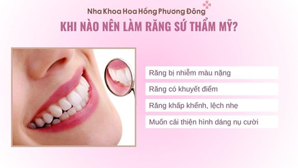 Nên làm răng sứ thẩm mỹ nếu tình trạng răng khỏe và muốn cải thiện nụ cười