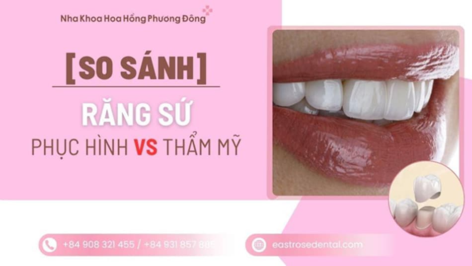 Sự khác biệt giữa răng sứ thẩm mỹ và răng sứ phục hình: Lựa chọn nào tốt nhất?