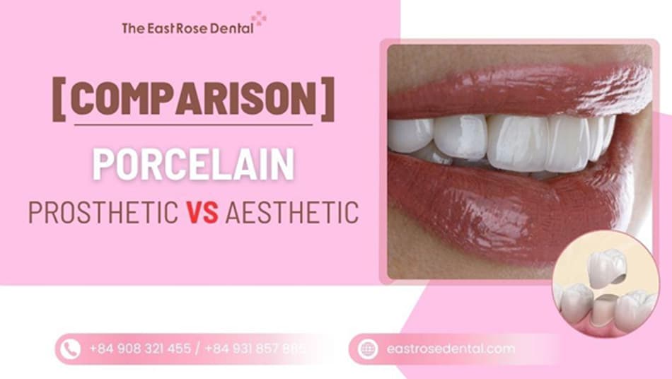 Cosmetic vs Prosthetic Dental Crowns: Which Is Best?