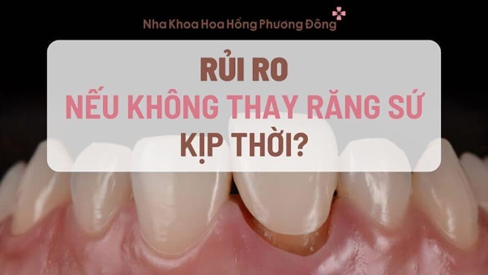 Răng sứ có vấn đề cần thay sớm để hạn chế ảnh hưởng đến sức khỏe răng miệng