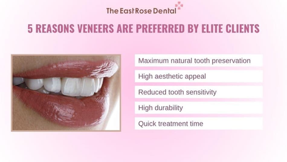 Porcelain Veneers Are the Preferred Choice Among High-End Clients