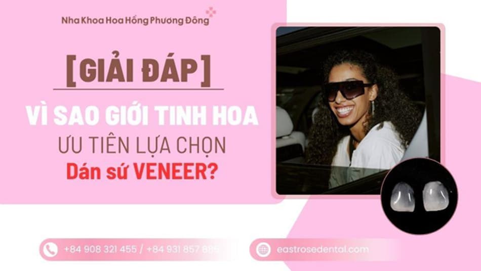 Vì sao người nổi tiếng, doanh nhân chọn dán sứ Veneer thay vì bọc sứ?