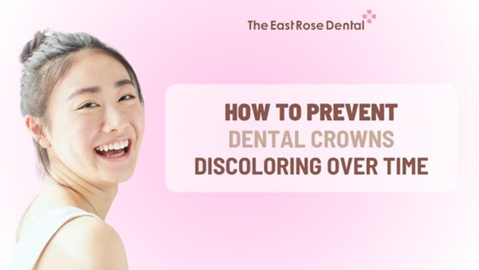 Some ways to help prevent dental crowns from discoloring over time