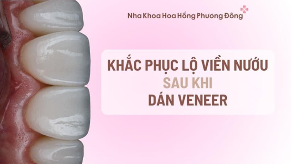 Can thiệp kịp thời giúp đảm bảo thẩm mỹ và sức khỏe răng miệng