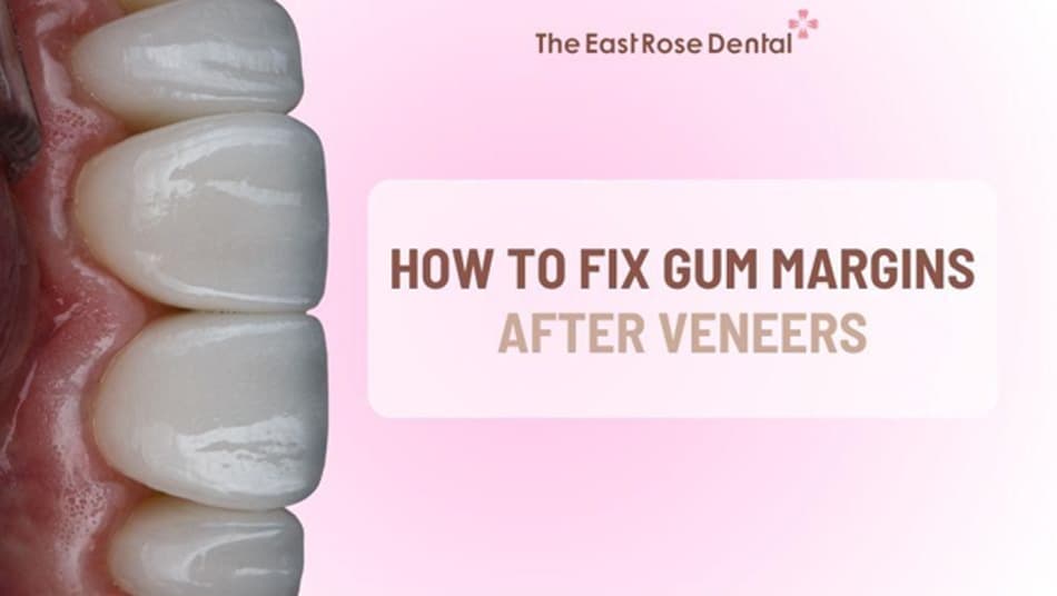 Timely treatment helps protect both aesthetics and oral health 