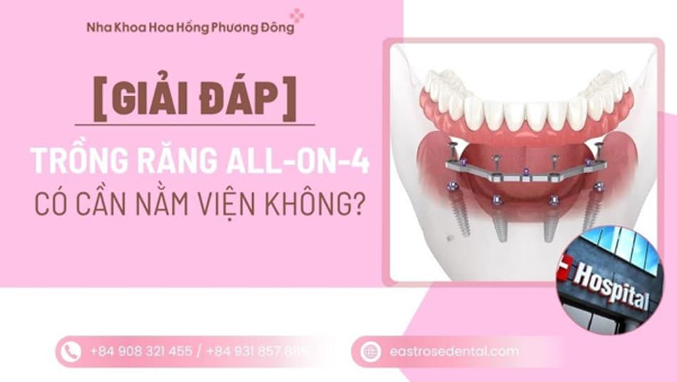 All-on-4 có cần nằm viện không? Quy trình diễn ra như thế nào?