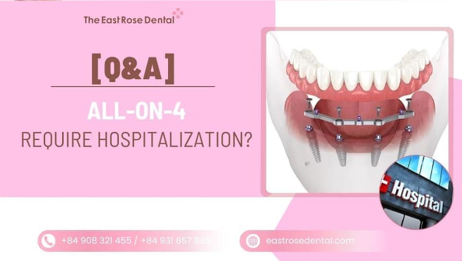 Does All-on-4 Require Hospitalization? Treatment Process Explained 