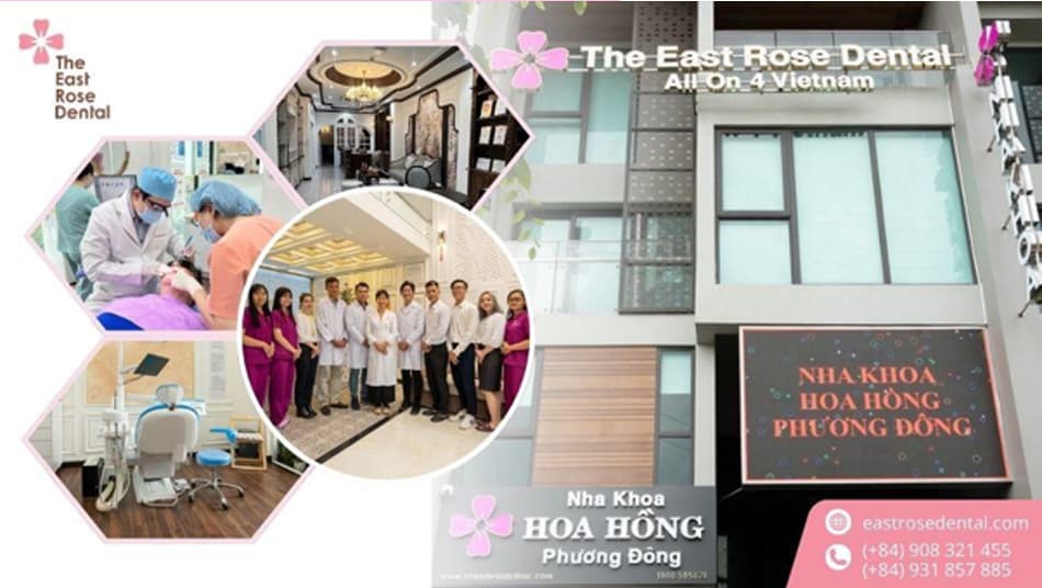 Nha Khoa Hoa Hồng Phương Đông là địa chỉ phục hình All-on-4 uy tín tại Tp.HCM