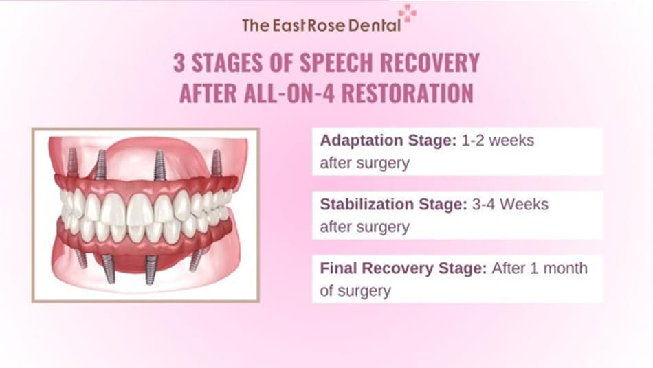 Patients Need Time to Adapt Their Speech After All-on-4 Restoration