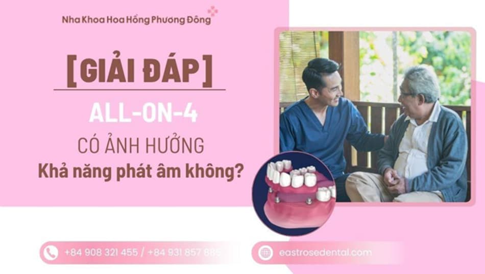 Phục hình All-on-4 có ảnh hưởng đến khả năng phát âm không?