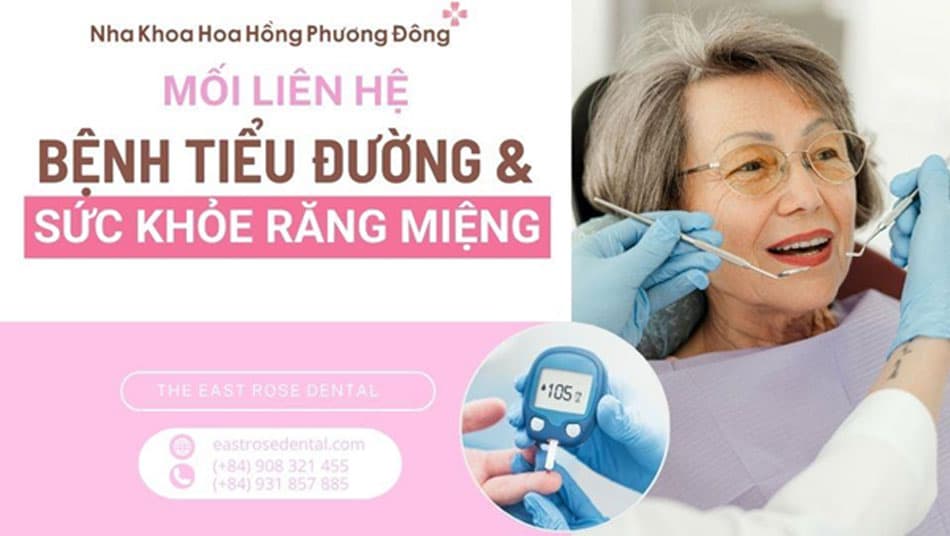 Sự tác động của bệnh tiểu đường lên sức khỏe răng miệng