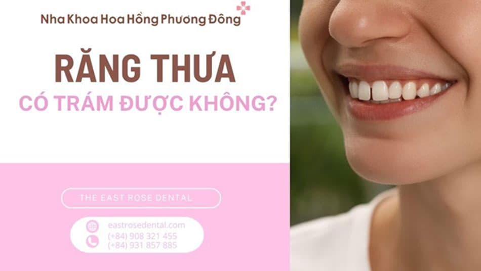 Răng thưa có trám được không? Trám răng thưa bao nhiêu tiền? 