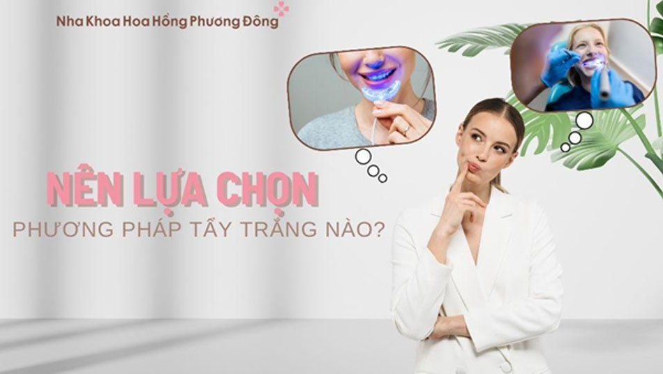 Lựa chọn phương pháp tẩy trắng phù hợp với ngân sách và tình trạng răng