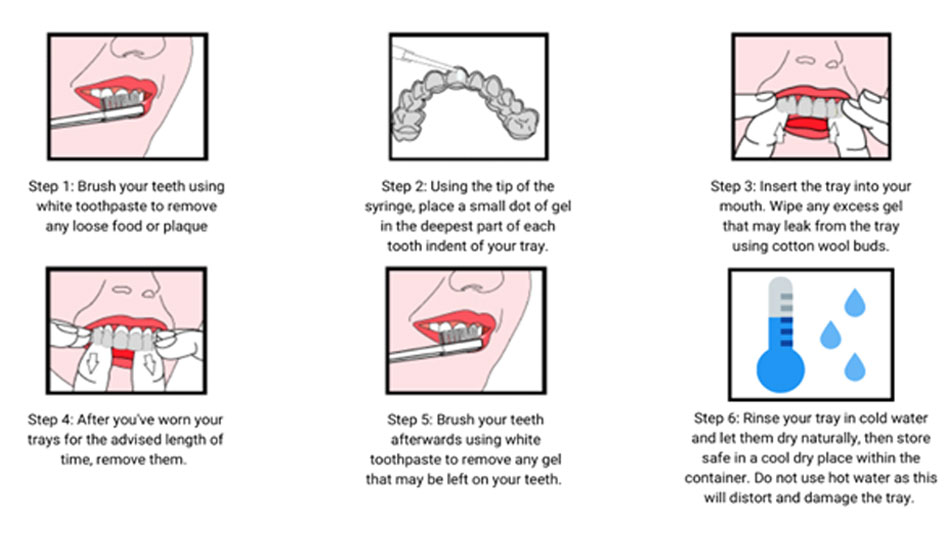 The East Rose Dental Clinic guides you on how to whiten your teeth at dental office