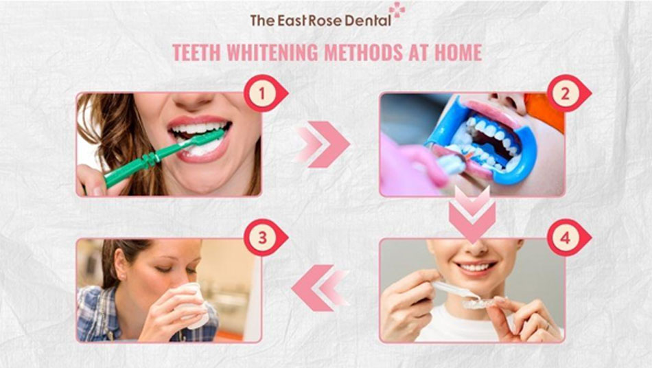The process of at-home teeth whitening