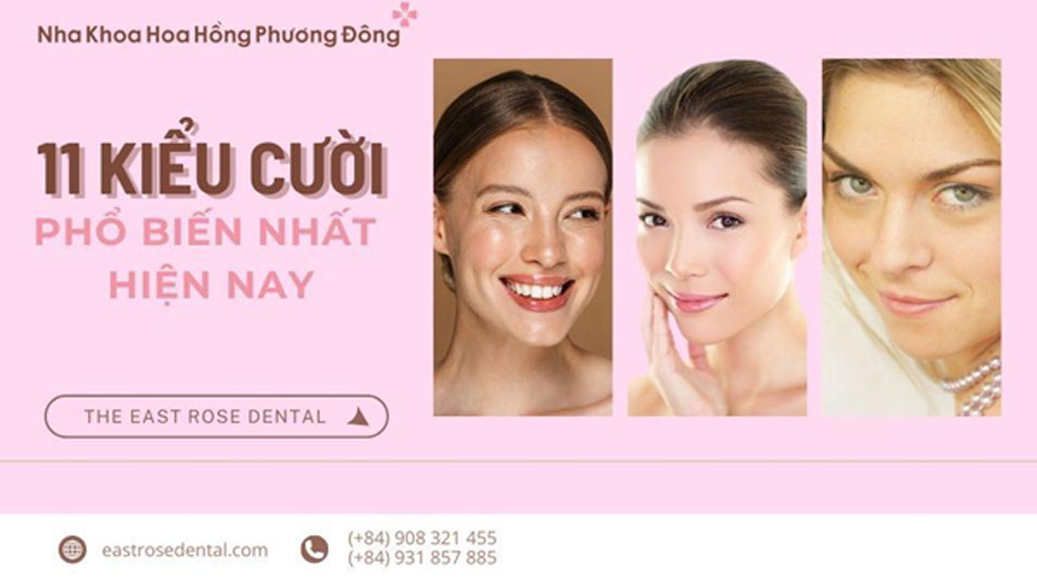 11 Kiểu cười phổ biến hiện nay và khám phá ý nghĩa của chúng