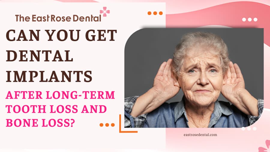 Can You Get Dental Implants After Long-Term Tooth Loss and Bone Loss?