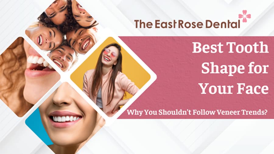 Best Tooth Shape for Your Face: Why You Shouldn’t Follow Veneer Trends