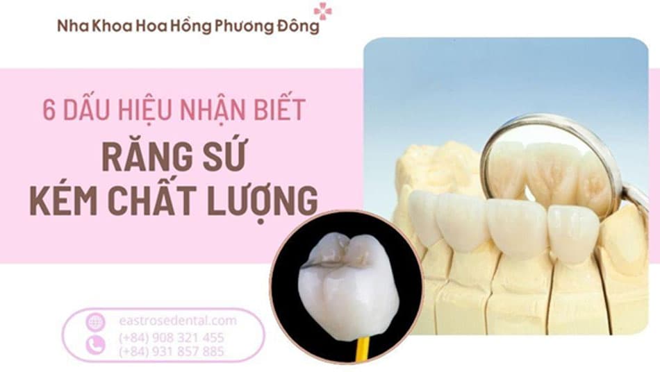6 Dấu Hiệu Nhận Biết Răng Sứ Chính Hãng Và Kém Chất Lượng