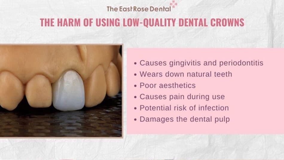Low-Quality Dental Crowns Can Cause Serious Harm