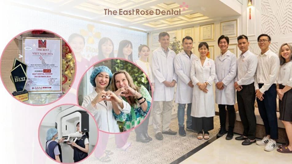 The East Rose Dental Clinic is a Leading Destination for Dental Crowns