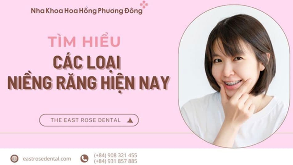 Niềng răng có mấy loại? Có làm răng bị yếu đi không?
