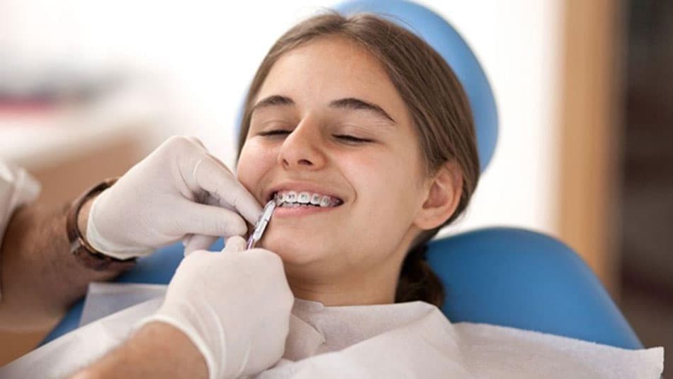 Niềng răng là phương pháp không ảnh hưởng đến sức khỏe của răng miệng
