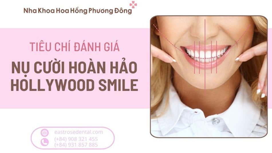Nụ cười hoàn hảo chuẩn Hollywood Smile cùng chuyên gia 