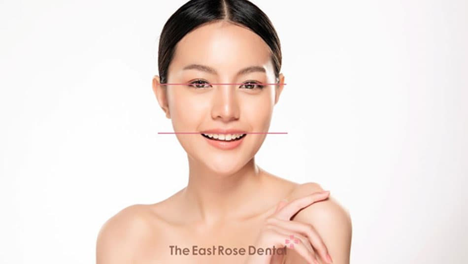 The smile line is the golden criterion that determines a perfect Hollywood smile