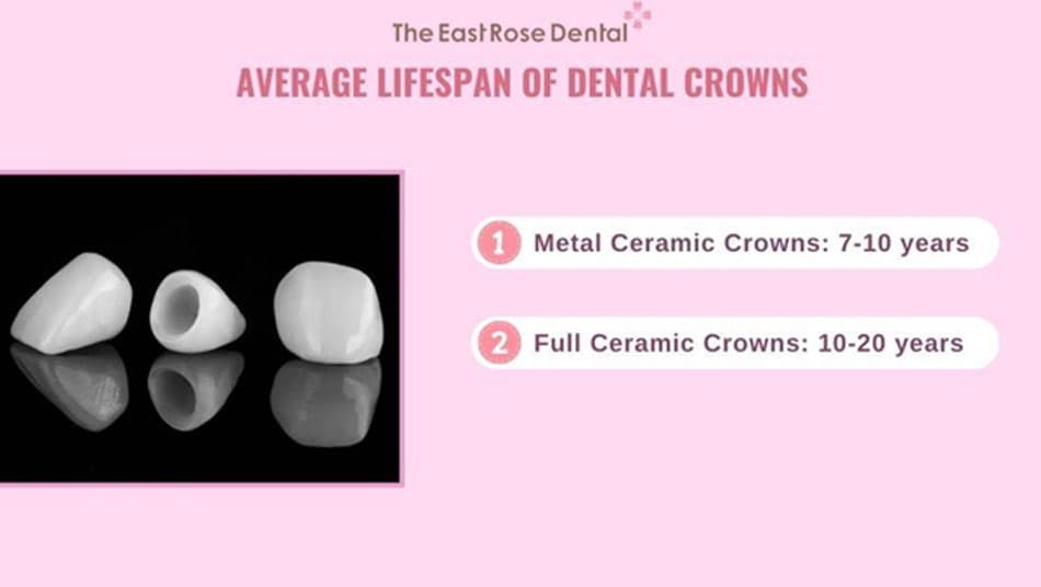 The lifespan of porcelain crowns is influenced by various factors