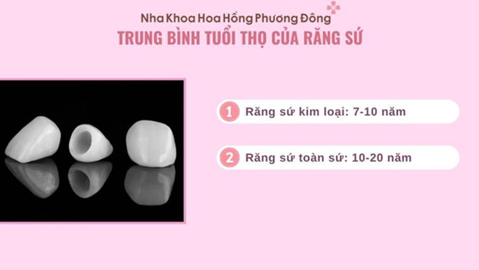 Tuổi thọ của răng sứ bị ảnh hưởng bởi nhiều yếu tố
