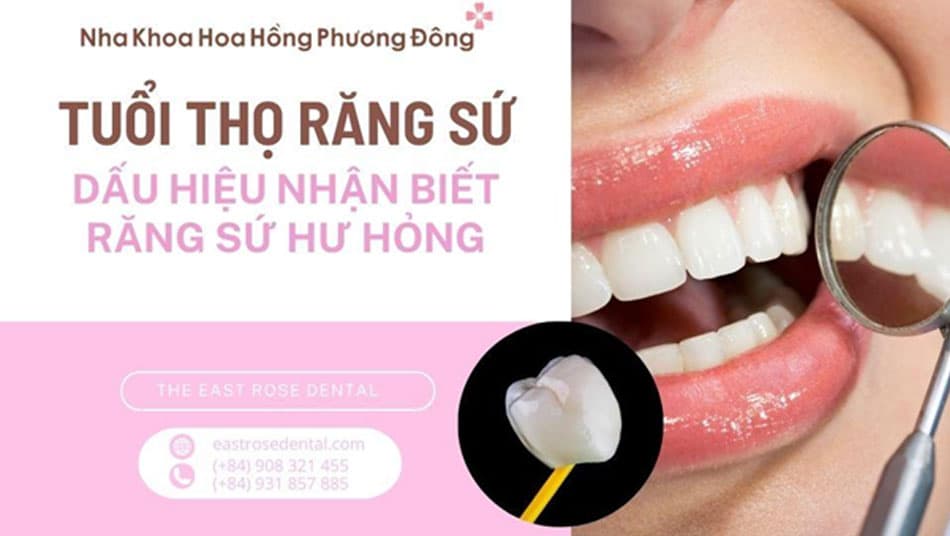 Tuổi Thọ Của Răng Sứ Và Cách Nhận Biết Dấu Hiệu Hư Hỏng
