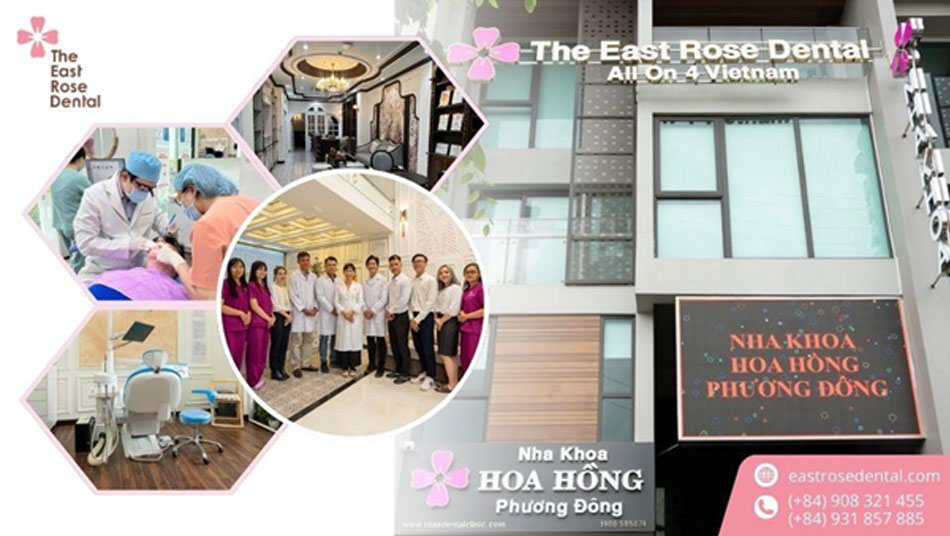 Nha Khoa Hoa Hồng Phương Đông là địa chỉ uy tín tại TPHCM