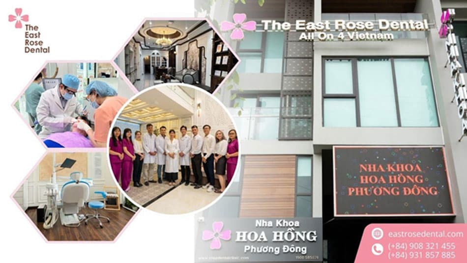 East Rose Dental Clinic – A Trusted and Experienced Dental Clinic
